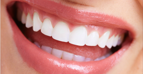 美しさと機能性を兼ね備えた歯に～セラミック治療・ホワイトニング～